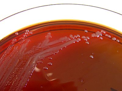 Neisseria meningitidis