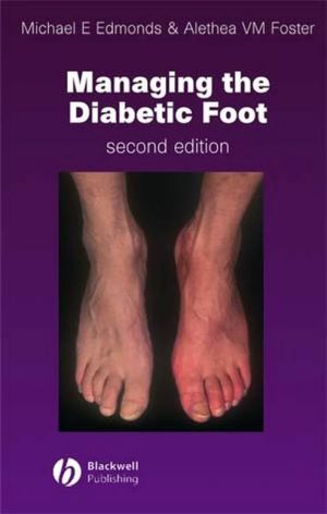 Book: Managing the Diabetic Foot