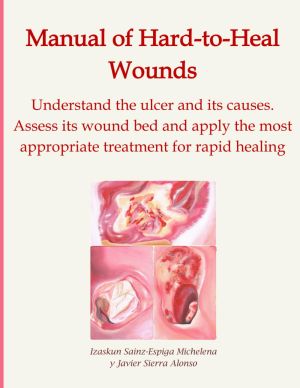 Manual of Hard-to-Heal Wound